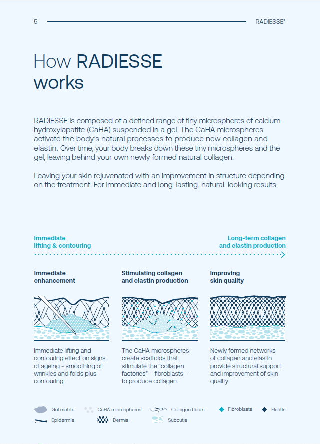 RADIESSE® PATIENT BROCHURE – Merz Aesthetics EPrint