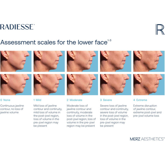 RADIESSE Lower Face Assessment scales