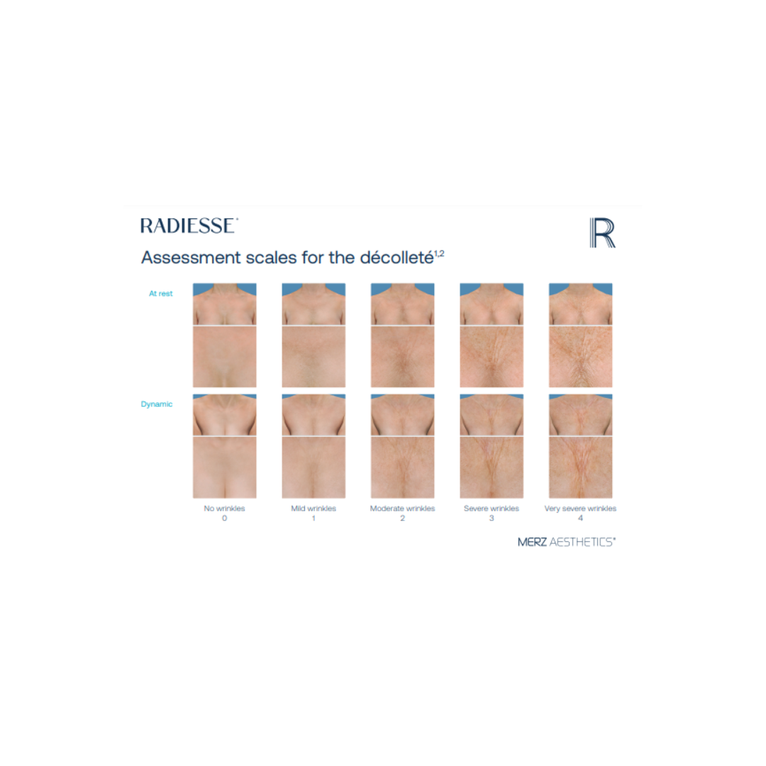 RADIESSE® DECOLLETE ASSESSMENT SCALES – Merz Aesthetics EPrint