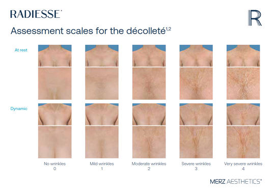 RADIESSE® DECOLLETE ASSESSMENT SCALES