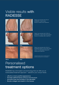 RADIESSE® PATIENT BROCHURE